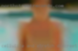 Cellulite and stretch discreet mark friendly  near Clayton TX.